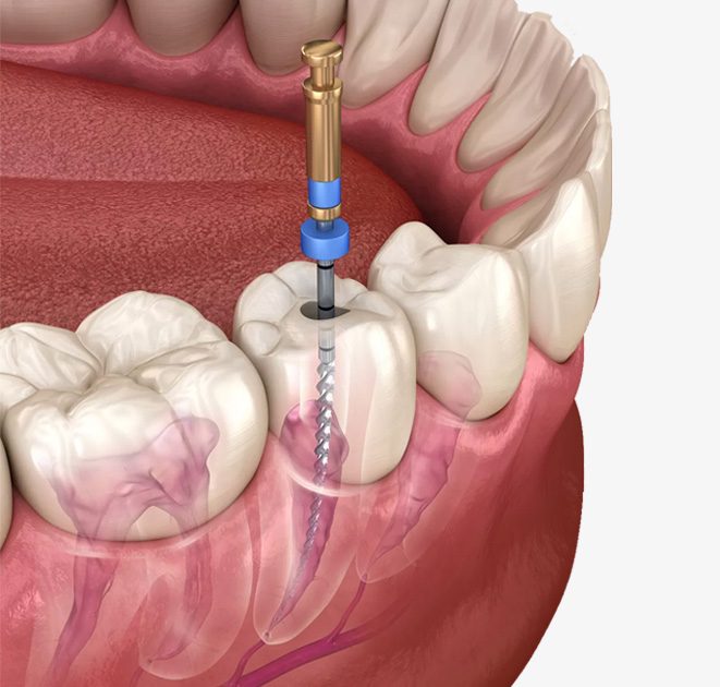 Çekmeköy diş tedavisi